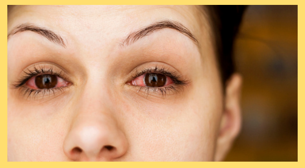 Top 10 Signs of Coronavirus You Should Know_9