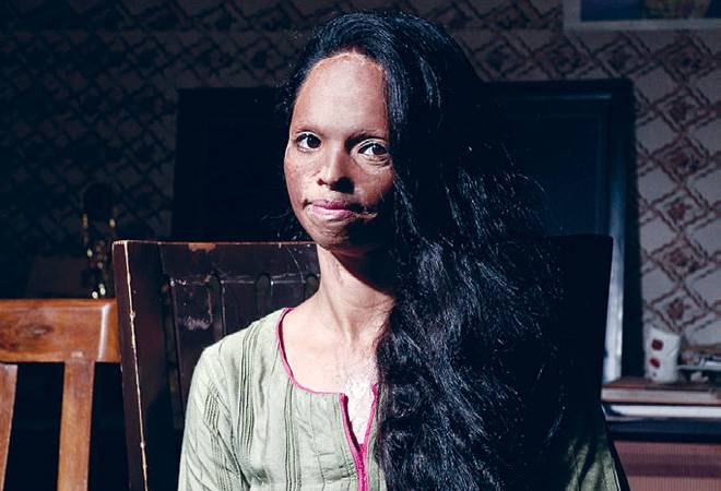 Success Story - Laxmi Agarwal Motivating Acid Attack Victims Relentlessly_Who is Laxmi Agarwal